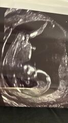 13+1 Nub?