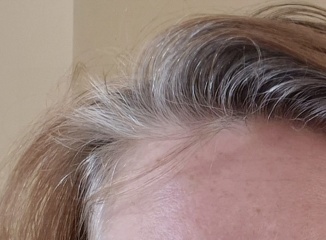 What colour hair dye?