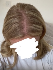 Are my highlights stripey?