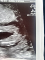 Potty shot confirmation
