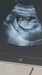 What do you see?