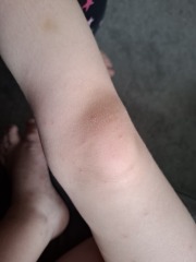 Calling parents and medical professionals please.