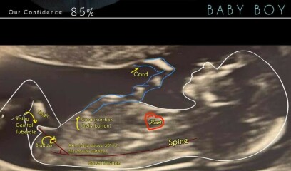 “Confirmed” nub theories