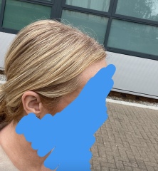 Are my highlights stripey?
