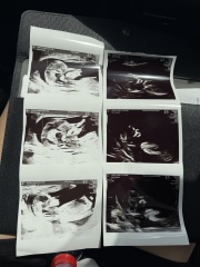 Boy or girl??