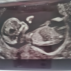 Nub - boy or girl?