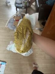 Normal baby poo for combo fed 5 month old?