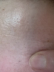 Have I tattooed my forehead? (Accidentally!)