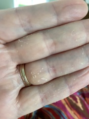 Photo, peeling hands and feet. Any ideas?