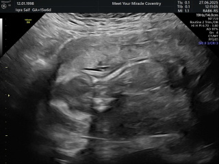 Baby gender 16 weeks scan
