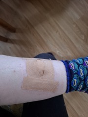 Do you want to see something *disgusting* on my leg?