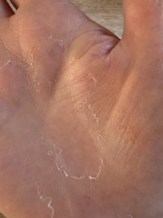 What’s this on my hands?