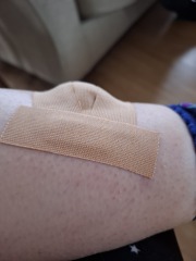 Do you want to see something *disgusting* on my leg?