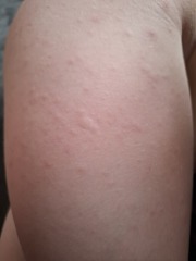 Calling parents and medical professionals please.