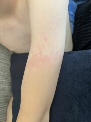 Is this heat rash or a reaction?