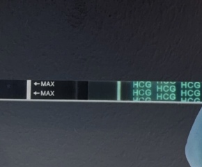 12DPO - Faint line on wondfo, negative clear blue?