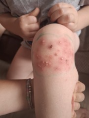 Is this a tonight emergency or can it wait to tomorrow?