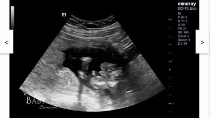 Is this definitely a boy?