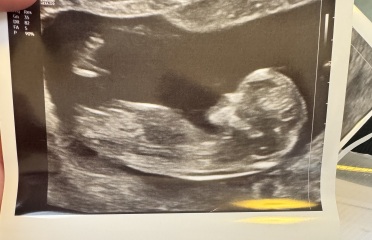 Due February 2026 - thread 2