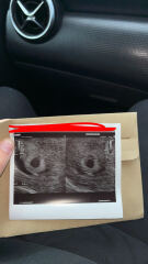 5 weeks pregnant scan…