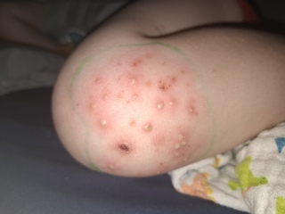 Is this a tonight emergency or can it wait to tomorrow?