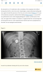 2 year old daughter swallowed a 50p coin !!!