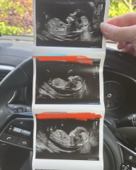 13 week scan - boy or girl?