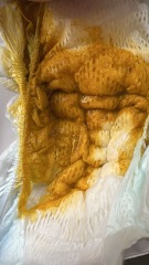 Persistent mucus in breastfed baby stool *photos*