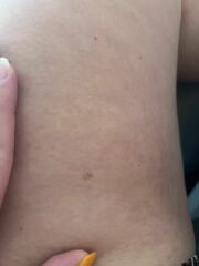 Are these moles..?