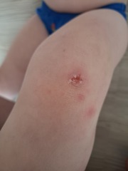 Is this a tonight emergency or can it wait to tomorrow?