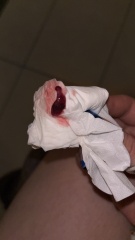 Is this a miscarriage?