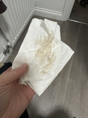 Should I be worried?