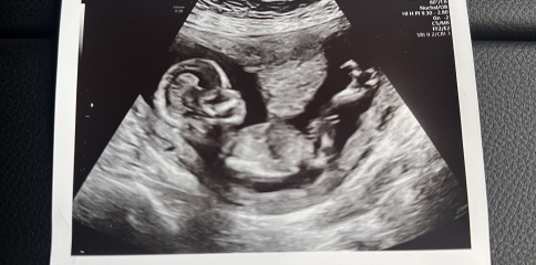 Any guesses for fun on my rainbow baby??!!!