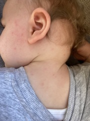 What does this look like to you? (Baby spots)