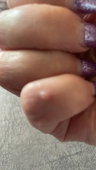 To ask you to identify this little lump?