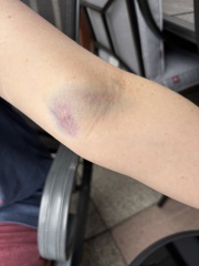 Blood test-is this normal (pic attached)