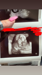 11.2 what do we think?