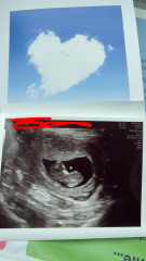 Fun gender guess 🤍