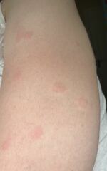 What on earth am I being bitten by? (Pics included)