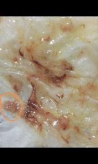 2 year old daughter swallowed a 50p coin !!!