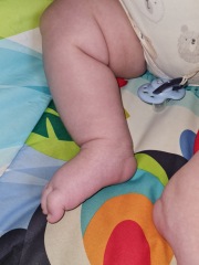 Baby breathing, subcostal retractions :(