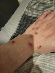 Identify my bites!