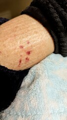 Mysterious Spots Under my Skin