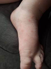 Calling parents and medical professionals please.