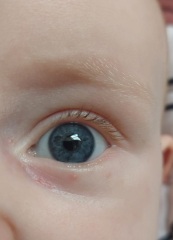 5 month old babies eye