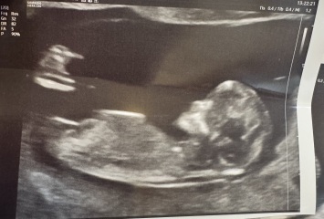 Due February 2026 - thread 2
