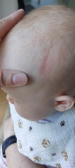 Baby leant on something and left a slight indent in head