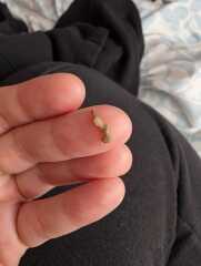 Tooth extraction healing