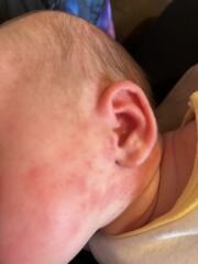 Does this look like a reaction or something else ?