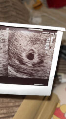 5 week scan…